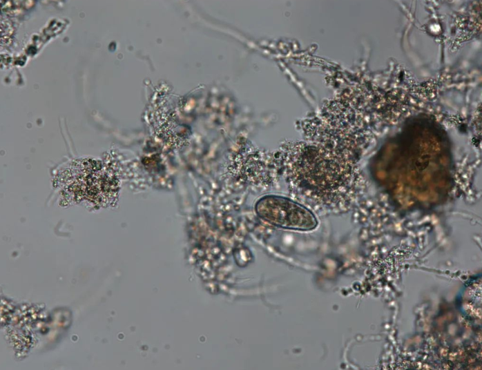 膜袋蟲(chóng)or尾絲蟲(chóng)，大佬們幫忙確認(rèn)一下？(圖1)